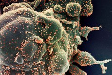 O estudo da UFPB  foi publicado pela revista científica Oxidative Medicine and Cellular Longevity, periódico com elevado fator de impacto (FI = 5,07). Na imagem, célula (em verde) em autodestruição, após ser gravemente infectada com partículas do novo coronavírus (em vermelho), a partir da amostra de um paciente.  Crédito: NIAID