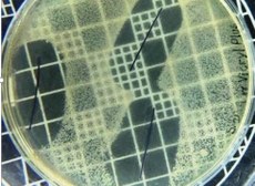 Na imagem, é possível verificar inibição de 20 mm utilizando os fios de sutura contendo agente antimicrobiano, frente à bactéria S.aureus, encontrada na pele e nas fossas nasais. Crédito: Fábio Sampaio